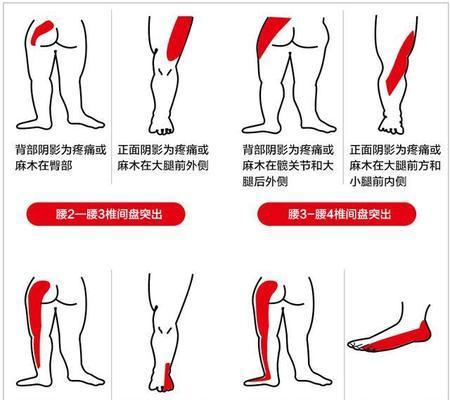 跑步机跑后头晕的原因及解决方法（运动后头晕怎么办）