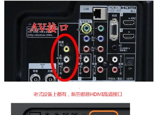 网络机顶盒怎么连接笔记本电脑？需要哪些设备？